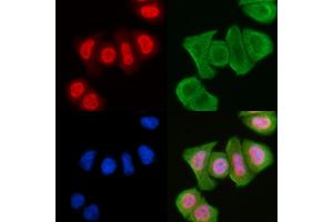 staining Hela cells(30 min of UV treatment) by IF/ICC. (MAPK8IP1 Antikörper  (pThr103))