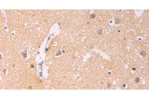 Immunohistochemistry of paraffin-embedded Human brain using ADCY1 Polyclonal Antibody at dilution of 1:60 (ADCY1 Antikörper)
