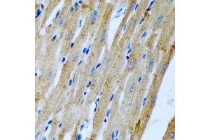 Immunohistochemical analysis of Fis1 staining in rat heart formalin fixed paraffin embedded tissue section. (Fission 1 Antikörper)