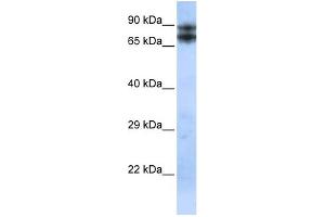 WB Suggested Anti-LIMA1 Antibody Titration:  0. (LIMA1 Antikörper  (N-Term))