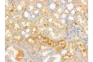 ABIN6256394 and ABIN6267617 at 1/100 staining human normal kidney tissue by IHC-P. (PKC delta Antikörper  (pSer645))