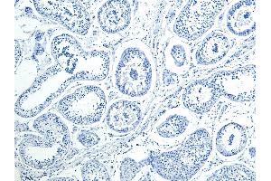 ABIN1590026 Negative Control showing staining of paraffin embedded Human Testis, with no primary antibody.