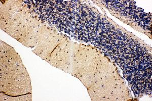 Immunohistochemistry (IHC) image for anti-Valosin Containing Protein (VCP) (AA 749-766), (C-Term) antibody (ABIN3043984)