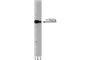 Western blot analysis of rabaptin-5 on a MCF-7 lysate. (RABEP1 Antikörper  (AA 247-417))