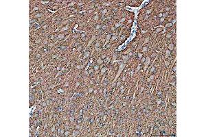 IHC analysis of Synapsin II using anti-Synapsin II antibody (ABIN4886735). (SYN2 Antikörper  (AA 497-582))