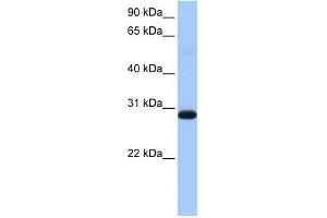 WARS2 antibody used at 1 ug/ml to detect target protein. (WARS2 Antikörper  (Middle Region))