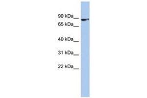 Image no. 1 for anti-Zinc Finger Protein 189 (ZNF189) (C-Term) antibody (ABIN6742390) (ZNF189 Antikörper  (C-Term))