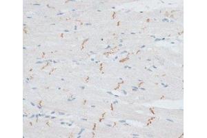 Immunohistochemistry of paraffin-embedded Rat heart using N-Cadherin Polyclonal Antibody at dilution of 1:100 (40x lens). (N-Cadherin Antikörper)
