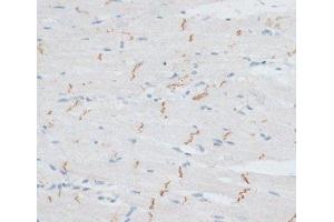 Immunohistochemistry of paraffin-embedded Rat heart using N-Cadherin Polyclonal Antibody at dilution of 1:100 (40x lens). (N-Cadherin Antikörper)