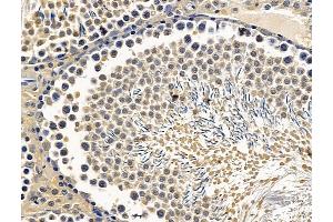 ABIN7096345 and ABIN7100407 at 1/100 staining rat testis tissue by IHC-P. (CEMP1 Antikörper)
