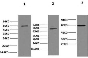 Western Blot analysis of 1) Hela, 2) 293T, 3) HepG2 cells using NFκB-p65 Monoclonal Antibody at dilution of 1:2000. (NF-kB p65 Antikörper)