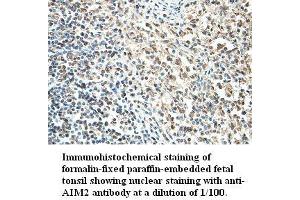 Image no. 1 for anti-Absent in Melanoma 2 (AIM2) antibody (ABIN791198) (AIM2 Antikörper)