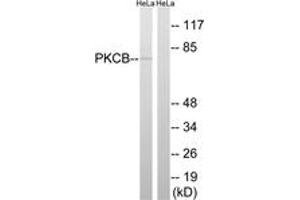 Western blot analysis of extracts from HeLa cells, using PKCB (Ab-661) Antibody. (PKC beta Antikörper  (AA 622-671))
