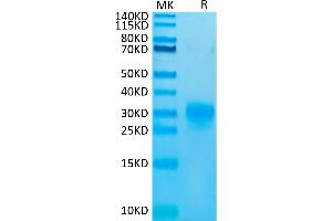 Biotinylated Human TSLP (R127A, R130A) on Tris-Bis PAGE under reduced condition. (Thymic Stromal Lymphopoietin Protein (TSLP) (Arg127Ala-Mutant, Arg130Ala-Mutant) (His-Avi Tag,Biotin))