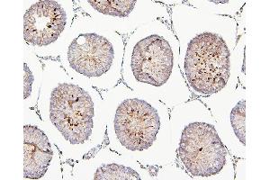 IHC analysis of TEK using anti-TEK antibody (ABIN7600762). (TEK Antikörper  (AA 23-616))