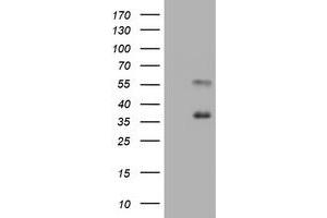 Image no. 2 for anti-Mucin 1 (MUC1) antibody (ABIN1499599) (MUC1 Antikörper)