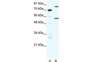 Western Blotting (WB) image for anti-Myoneurin (MYNN) antibody (ABIN2460664)
