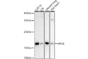 Western Blotting (WB) image for anti-Myosin Regulatory Light Polypeptide 9 (MYL9) (AA 1-100) antibody (ABIN3023463)