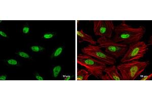 ICC/IF Image OCT1 antibody detects OCT1 protein at nucleus by immunofluorescent analysis. (POU2F1 Antikörper)
