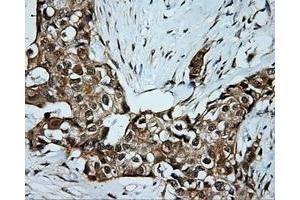 Immunohistochemical staining of paraffin-embedded Kidney tissue using anti-SRR mouse monoclonal antibody. (SRR Antikörper)