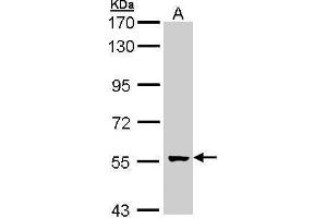 WB Image Sample (30 ug of whole cell lysate) A: A431 , 7. (GCM2 Antikörper  (Center))
