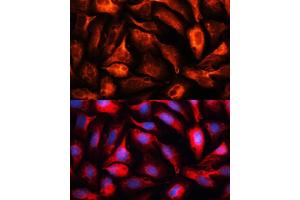 Immunofluorescence analysis of U2OS cells using MB antibody (ABIN1680748, ABIN3017668, ABIN3017669 and ABIN6220205) at dilution of 1:100. (MAP1B Antikörper  (AA 1820-2100))