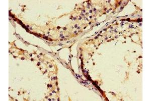 Immunohistochemistry of paraffin-embedded human testis tissue using ABIN7175675 at dilution of 1:100