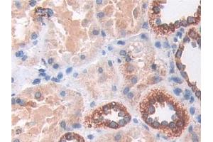 Immunohistochemistry (IHC) image for anti-Superoxide Dismutase 2, Mitochondrial (SOD2) (AA 25-222) antibody (ABIN7442672)