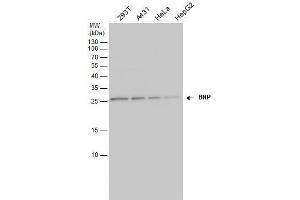 WB Image BNP antibody detects BNP protein by western blot analysis. (NPPB Antikörper)