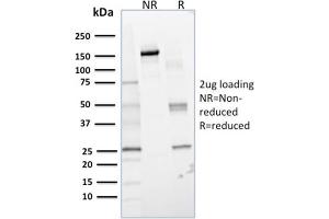 SDS-PAGE (SDS) image for anti-Glyoxalase I (GLO1) antibody (ABIN6939533)