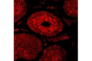 IF analysis of SAE1 using anti-SAE1 antibody (ABIN7601346). (SAE1 Antikörper  (AA 33-299))
