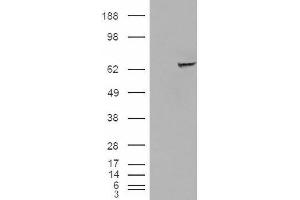 Image no. 2 for anti-Insulin-Like Growth Factor 2 mRNA Binding Protein 2 (IGF2BP2) (C-Term) antibody (ABIN374940) (IGF2BP2 Antikörper  (C-Term))