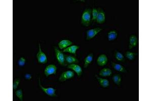 Immunofluorescence (IF) image for anti-serpin Peptidase Inhibitor, Clade A (Alpha-1 Antiproteinase, Antitrypsin), Member 6 (SERPINA6) (AA 136-405) antibody (ABIN7148620)