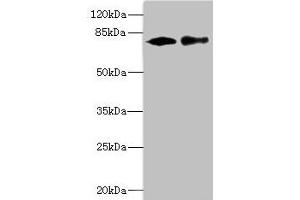 Western blot All lanes: CALCOCO1 antibody at 1. (CALCOCO1 Antikörper  (AA 462-691))