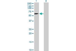 Western Blot analysis of ZNF280B expression in transfected 293T cell line by ZNF280B MaxPab polyclonal antibody. (ZNF280B Antikörper  (AA 1-543))