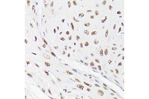 Immunohistochemistry (IHC) image for anti-Leo1, Paf1/RNA Polymerase II Complex Component, Homolog (S. Cerevisiae) (LEO1) antibody (ABIN6133790)