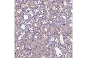 Immunohistochemical staining of human kidney with C16orf88 polyclonal antibody  shows strong cytoplasmic positivity in tubular cells at 1:50-1:200 dilution. (KNOP1 Antikörper)