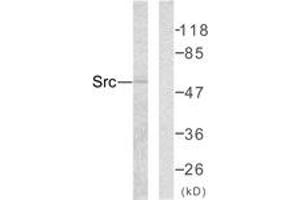 Western blot analysis of extracts from COLO205 cells, using Src (Ab-418) Antibody. (Src Antikörper  (AA 386-435))