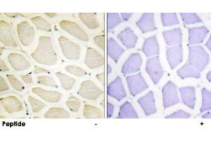 Immunohistochemistry analysis of paraffin-embedded human skeletal muscle tissue using COL20A1 polyclonal antibody . (COL20A1 Antikörper  (C-Term))