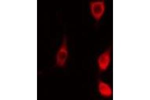Immunofluorescence (fixed cells) (IF/ICC) image for anti-Mitogen-Activated Protein Kinase-Activated Protein Kinase 2 (MAPKAPK2) (C-Term) antibody (ABIN6263120)