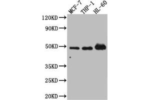 Western Blot Positive WB detected in: MCF-7 whole cell lysate, THP-1 whole cell lysate, HL-60 whole cell lysate All lanes: Vitamin D antibody at 1:1000 Secondary Goat polyclonal to rabbit IgG at 1/50000 dilution Predicted band size: 49, 54 kDa Observed band size: 49 kDa (Rekombinanter Vitamin D Receptor Antikörper)