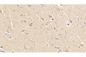 Detection of DMD in Human Cerebrum Tissue using Monoclonal Antibody to Dystrophin (DMD) (Dystrophin Antikörper  (AA 253-597))