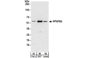 Western Blotting (WB) image for anti-6-phosphofructo-2-Kinase/fructose-2,6-Biphosphatase 3 (PFKFB3) (AA 470-520) antibody (ABIN7450556)