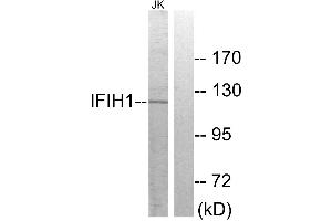Western blot analysis of extracts from Jurkat cells, using IFIH1 antibody. (IFIH1 Antikörper)