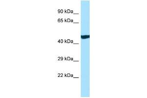 WB Suggested Anti-ANKRD33 Antibody Titration: 1. (ANKRD33 Antikörper  (C-Term))