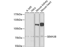 Western blot analysis of extracts of various cell lines, using SEMB Antibody (ABIN6132644, ABIN6147511, ABIN6147512 and ABIN6222774) at 1:1000 dilution. (SEMA3B Antikörper  (AA 569-748))