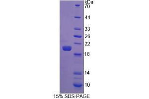 SDS-PAGE analysis of Human FGF22 Protein. (FGF22 Protein)