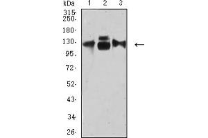 Western Blotting (WB) image for anti-Integrin, alpha 3 (ITGA3) (AA 63-248) antibody (ABIN5684113)