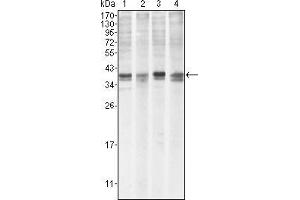 Western blot analysis using MCL1 mouse mAb against Hela (1), BCBL-1 (2), Jurkat (3) and HL60 (4) cell lysate. (MCL-1 Antikörper)