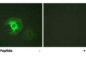 Immunofluorescence analysis of HeLa cells, using CALD1 polyclonal antibody . (Caldesmon Antikörper)
